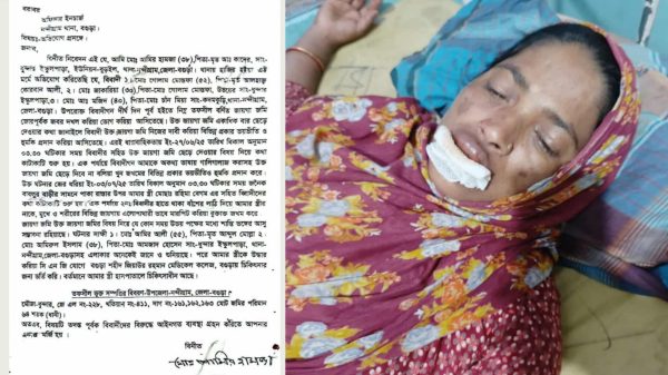 নন্দীগ্রামে জায়গা জমির জেরে প্রতিপক্ষের হামলায় নারী আহত, থানায় অভিযোগ 